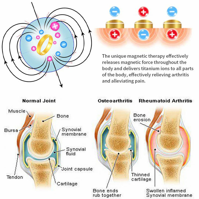 (🔥 LAST DAY SALE-80% OFF) DIYSTAR💖Lymphatic magnetic therapy cats eye ring